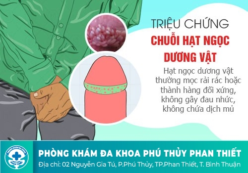 Nổi mụn trắng ở bao quy đầu 