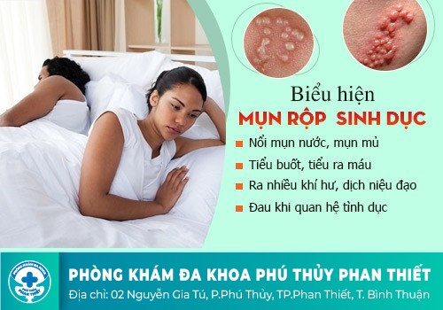 Nguyên nhân khiến bao quy đầu sưng tấy?