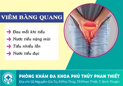Viêm bàng quang 