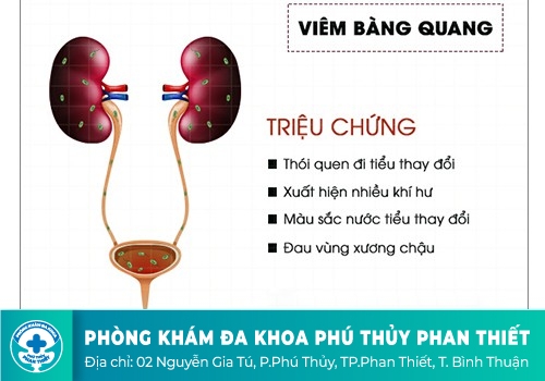 Bệnh viêm bàng quang là gì?