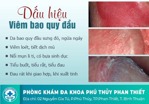 Nguyên nhân nứt bao quy đầu, rách bao quy đầu 