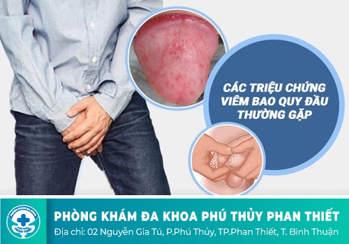 NGỨA BAO QUY ĐẦU LÀ DO BỆNH GÌ GÂY RA?