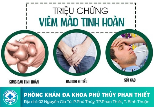 Đặc điểm chính của tình trạng nang mào tinh hoàn?