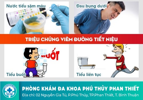 Biểu hiện nhận biết các bệnh lý xuất phát ở đường tiết niệu
