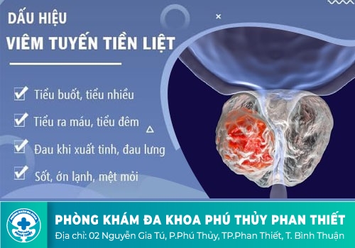 Viêm tuyến tiền liệt