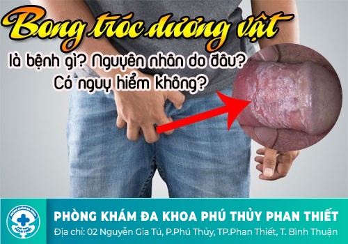 Tình trạng bao quy đầu bị bong tróc da và nguyên nhân gây ra