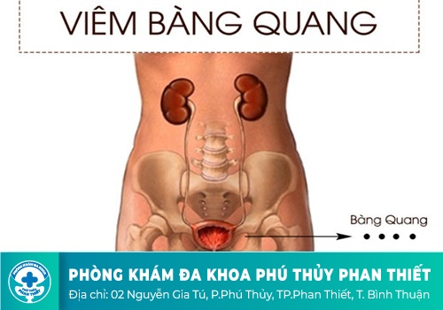 Bị viêm bàng quang có quan hệ tình dục được không?