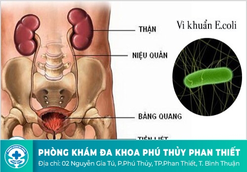 Dấu hiệu tiểu đêm cảnh báo bệnh gì?
