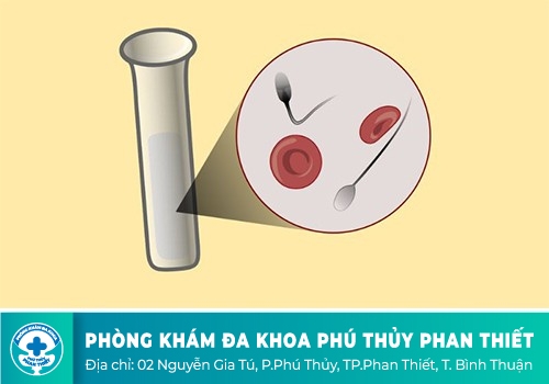 Hiện tượng xuất tinh muộn ở nam giới là gì?