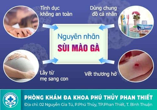 Hình ảnh nhận biết bệnh sùi mào gà