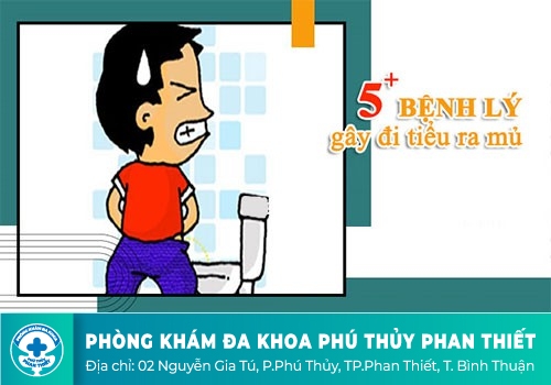 Đau buốt khi đi tiểu