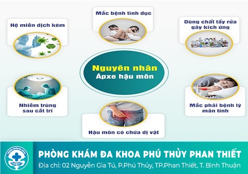Nguyên nhân apxe hậu môn thường gặp