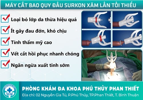 PHƯƠNG PHÁP ĐIỀU TRỊ DÀI BAO QUY ĐẦU HIỆU QUẢ, AN TOÀN