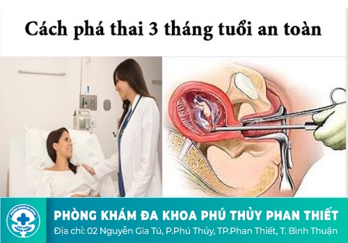 phá thai 3 tháng tuổi