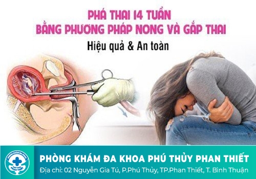 Phương pháp phá thai trên 14 tuần tuổi