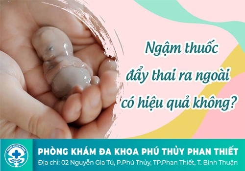 Uống thuốc phá thai