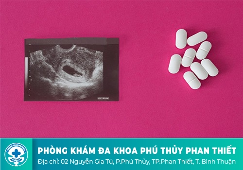 Các loại thuốc tiêu thai an toàn