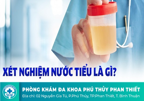 Xét nghiệm nước tiểu