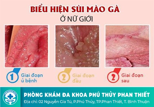 Bệnh xã hội