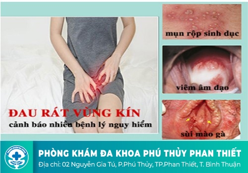 Đau rát âm đạo ở nữ giới