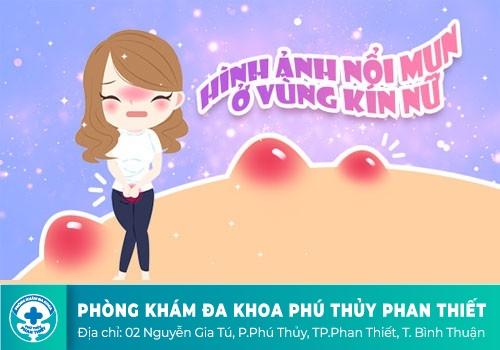 âm đạo lại nổi mụn