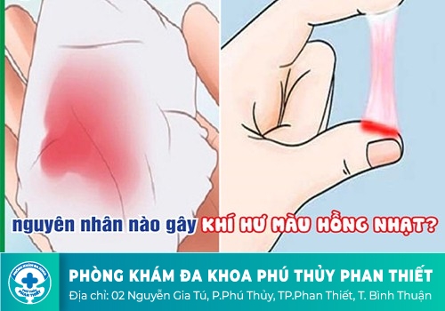 Huyết trắng có màu hồng
