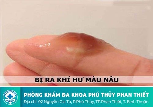 Khí hư có màu đen