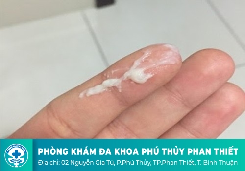 Ung thư cổ tử cung