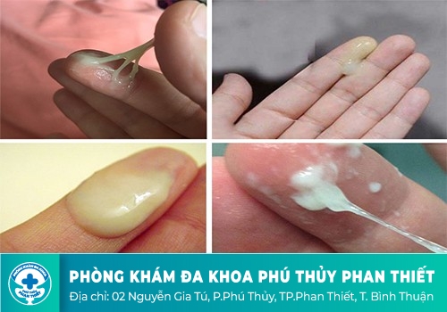 DẤU HIỆU KHÍ HƯ BẤT THƯỜNG