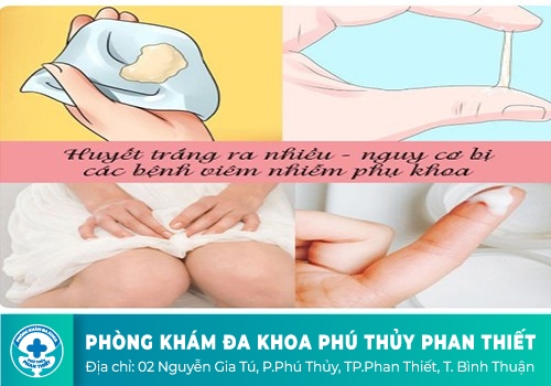 Nguyên nhân gây khí hư ra nhiều