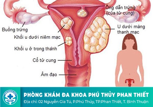  Nguyên nhân kinh nguyệt không đều