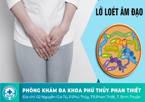 lở loét âm đạo