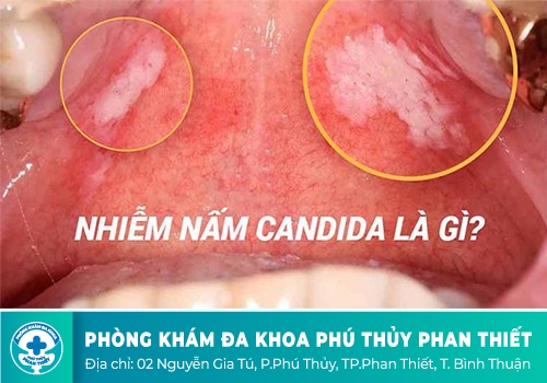 Nấm Candida