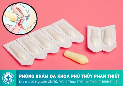 Trị nấm phụ khoa bằng phác đồ thuốc đặc hiệu