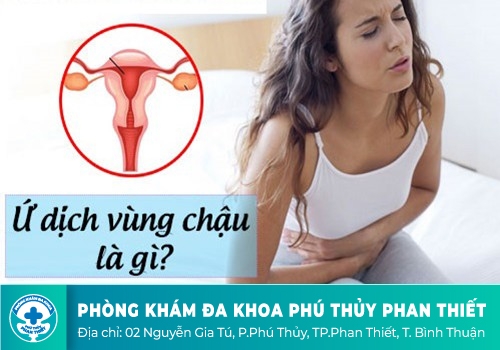 Ứ dịch vùng chậu 