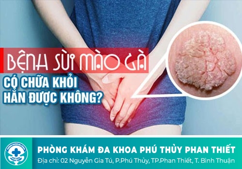 Sùi mào gà có tự khỏi không?