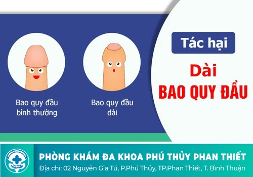 Dài bao quy đầu có quan hệ được không?