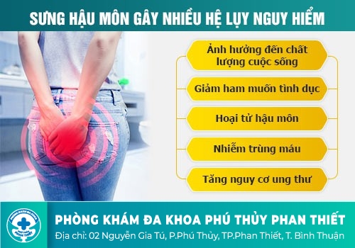 SƯNG HẬU MÔN CÓ THỂ LÀ DẤU HIỆU CỦA NHIỀU BỆNH LÝ