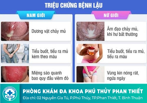 Biểu hiện của bệnh lậu ở nam giới