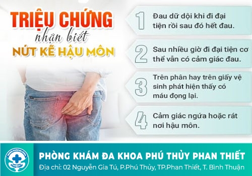 Nứt kẽ hậu môn