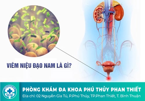Đái buốt ở nam giới là dấu hiệu của bệnh gì?