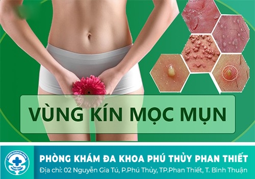 âm đạo mụn ngứa